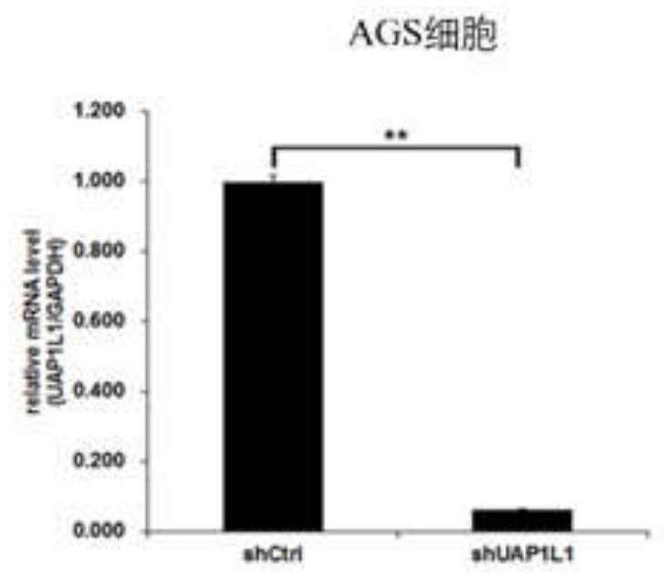 Application of human UAP1L1 gene and related product