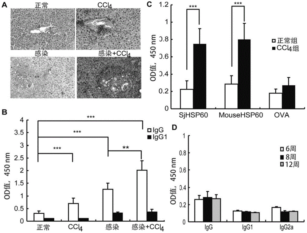 Application of SHSP60 for preparing diagnostic reagent for monitoring comprehensive hepatic pathology injury degree of schistosomiasis patient