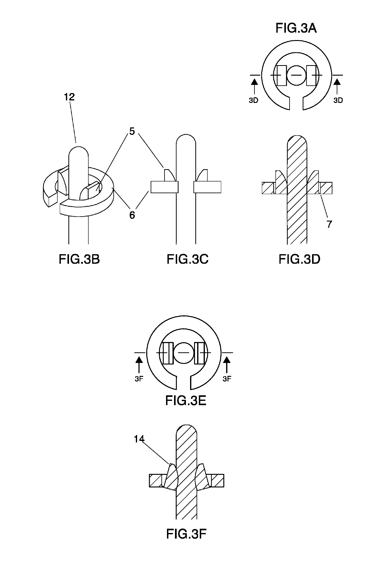 Advancement or retraction device