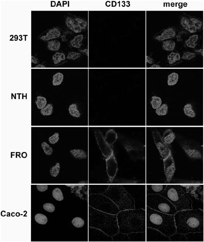 Drug conjugate of nucleic acid aptamer in targeted combination with CD133 protein and application of drug conjugate