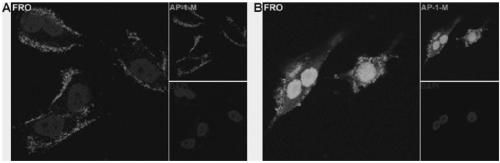 Drug conjugate of nucleic acid aptamer in targeted combination with CD133 protein and application of drug conjugate