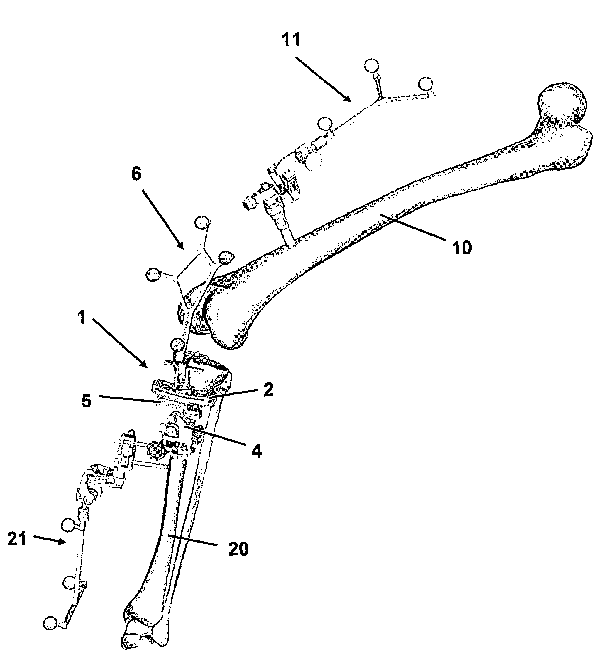 User guidance in adjusting bone incision blocks