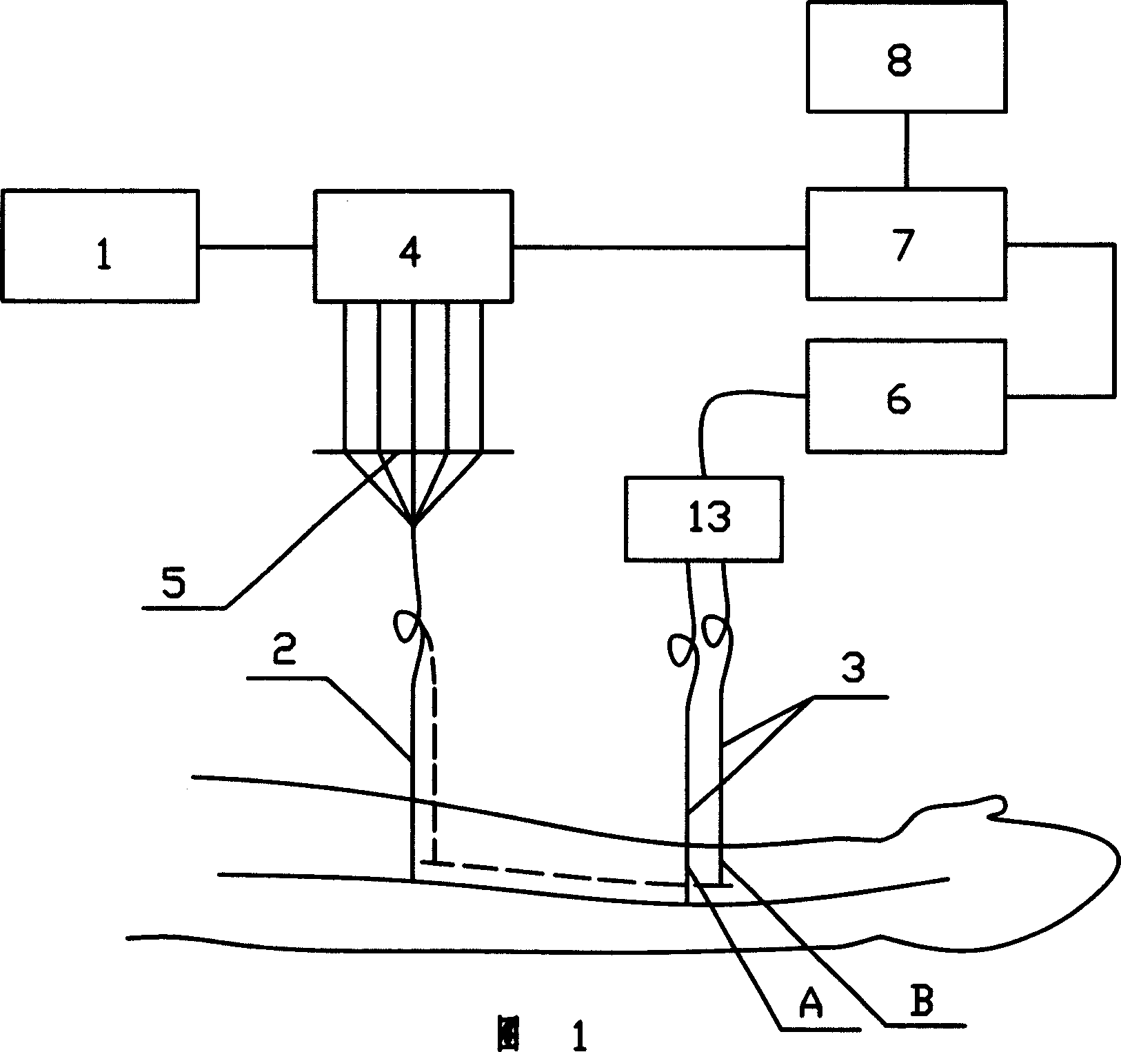 Transvenous optical charactr nondestructive testing method and apparatus therefor