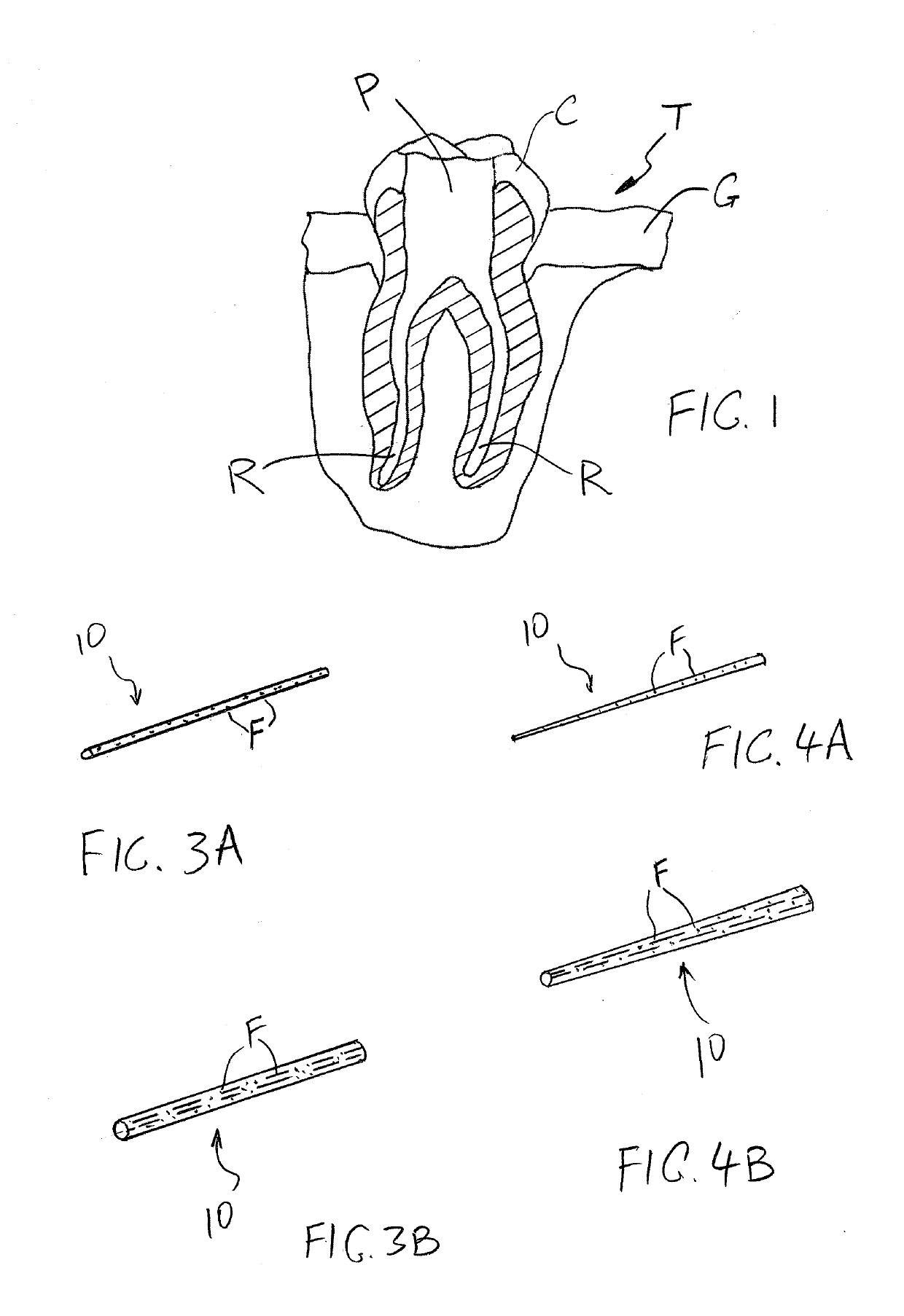 Absorbent inserts for tooth cavities