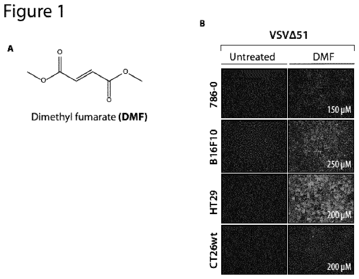 Compositions And Methods for Enhancing Production, Growth, Spread, or Oncolytic and Immunotherapeutic Efficacy of Interferon-Sensitive Viruses