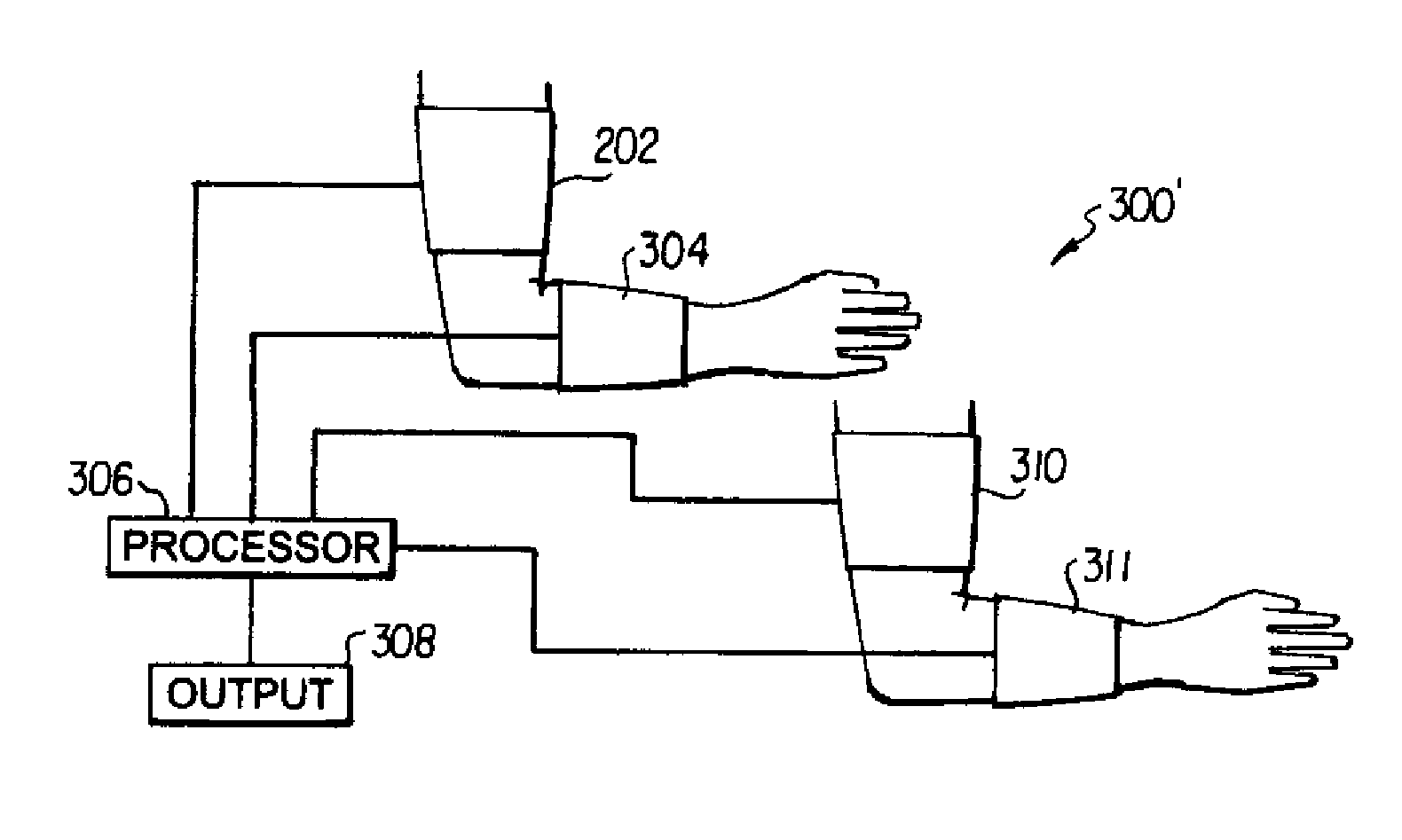 Impedance based device for non-invasive measurement of blood pressure and ankle-brachial index