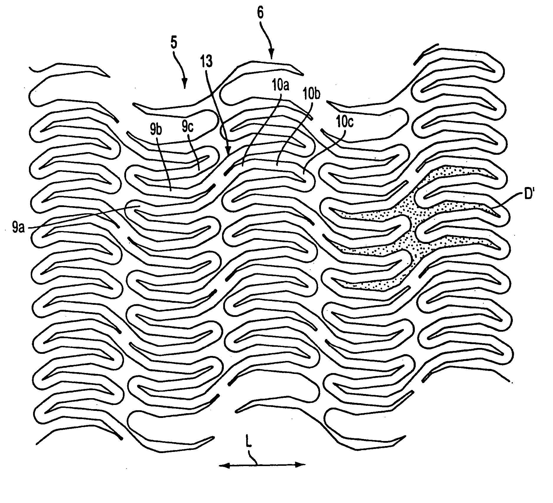 Methods and apparatus for a stent having an expandable web structure and delivery system