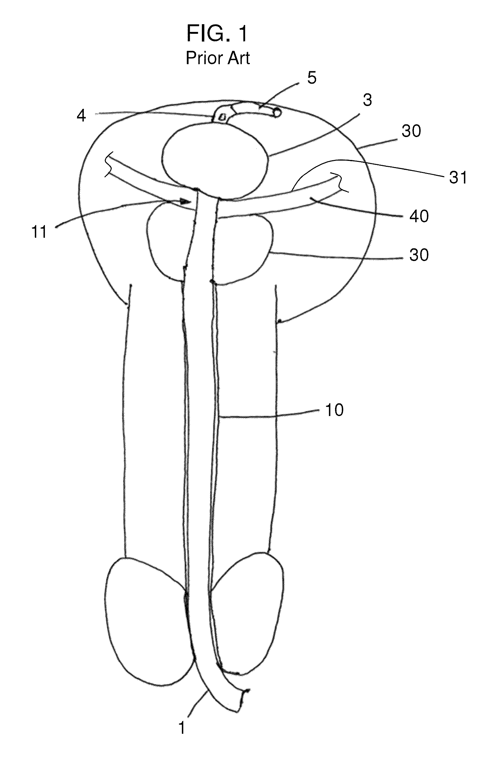 Stretch valve balloon catheter and methods for producing and using same