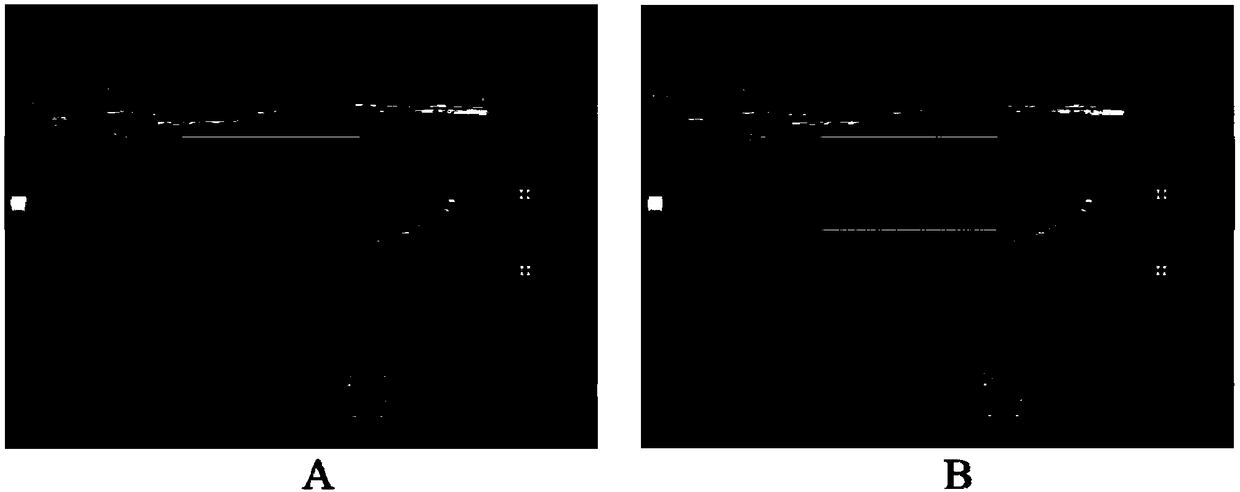 Thyroid tumor ultrasonic image recognition method and device