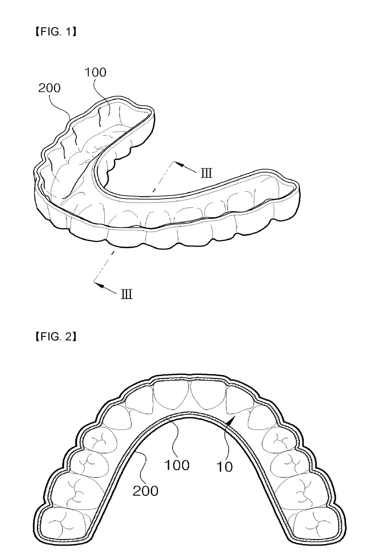 Orthodontic braces