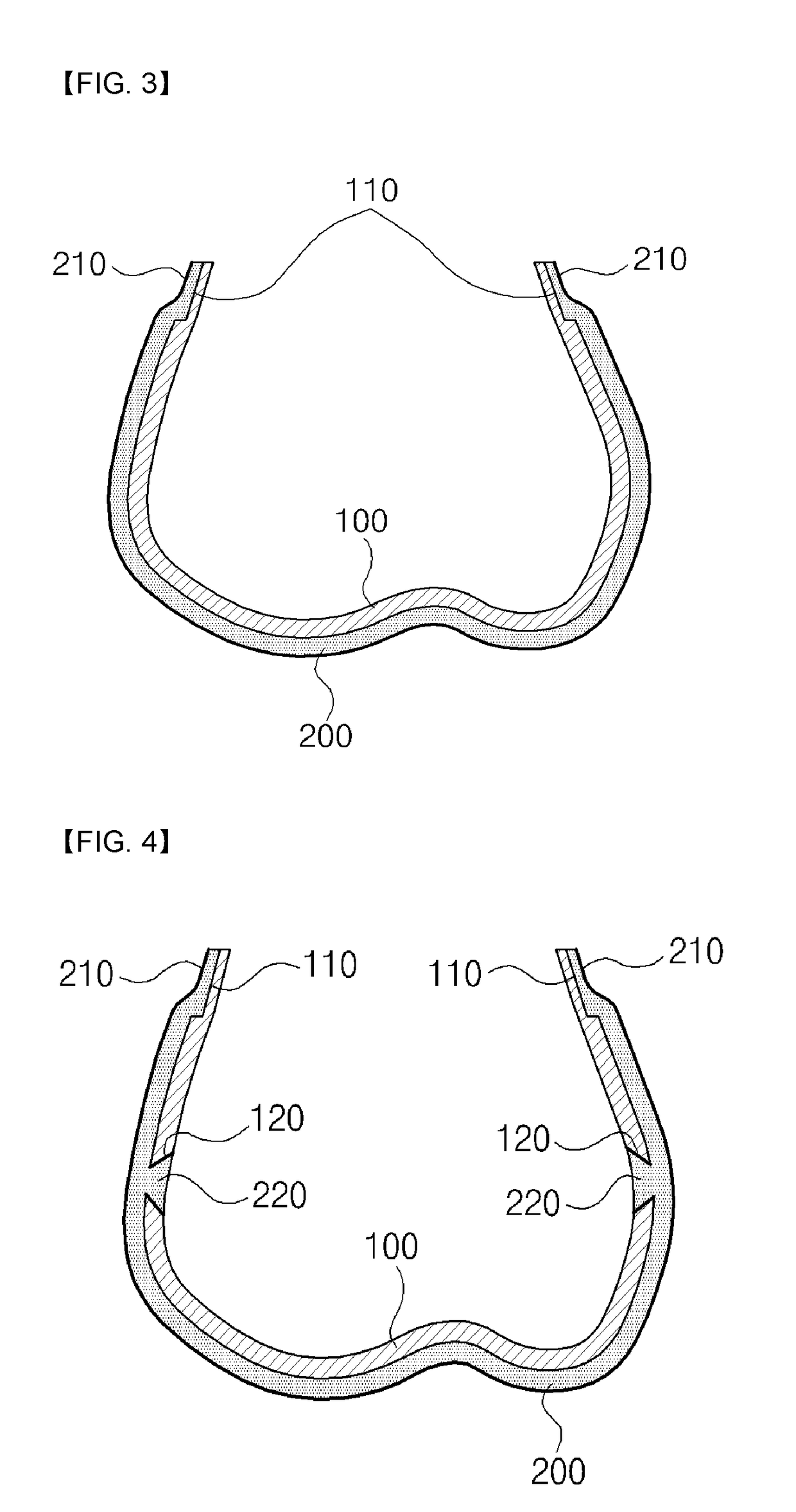 Orthodontic braces