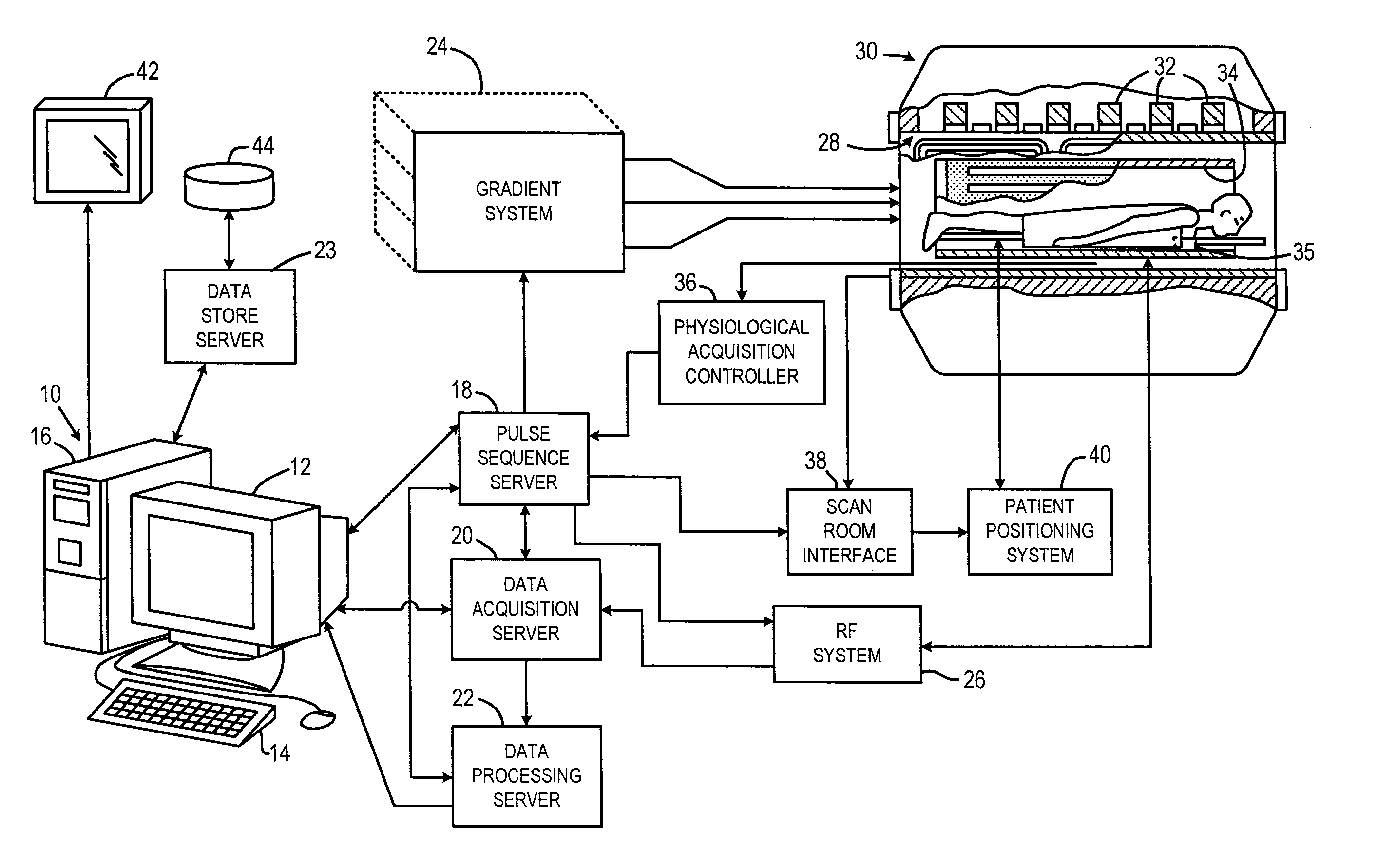 Local MRI breast coil and method of use