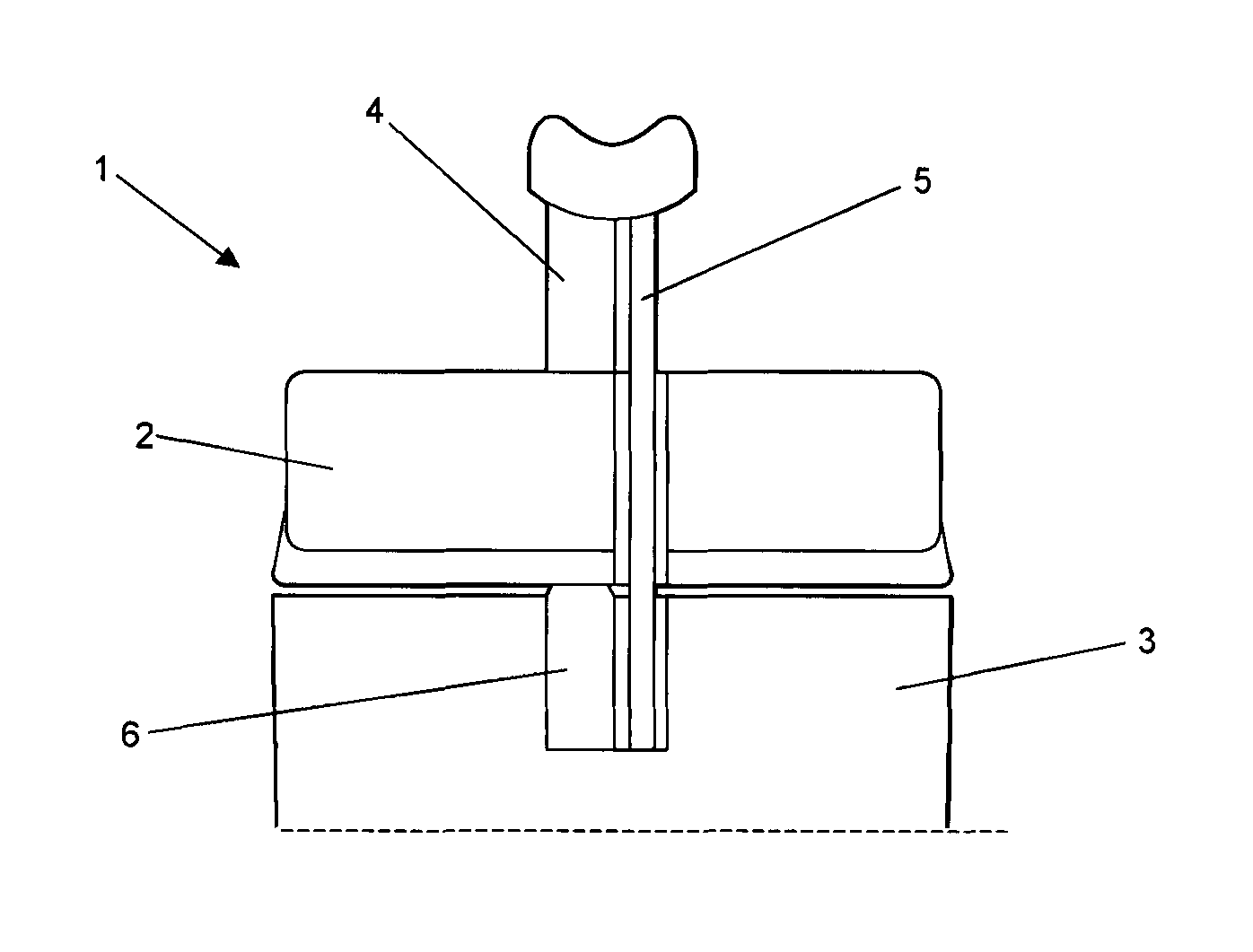 Suction chamber