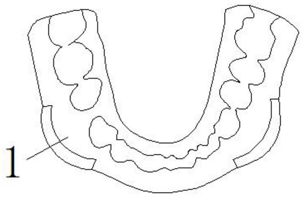 Individualized craniofacial navigation and registration guide plate and its registration method