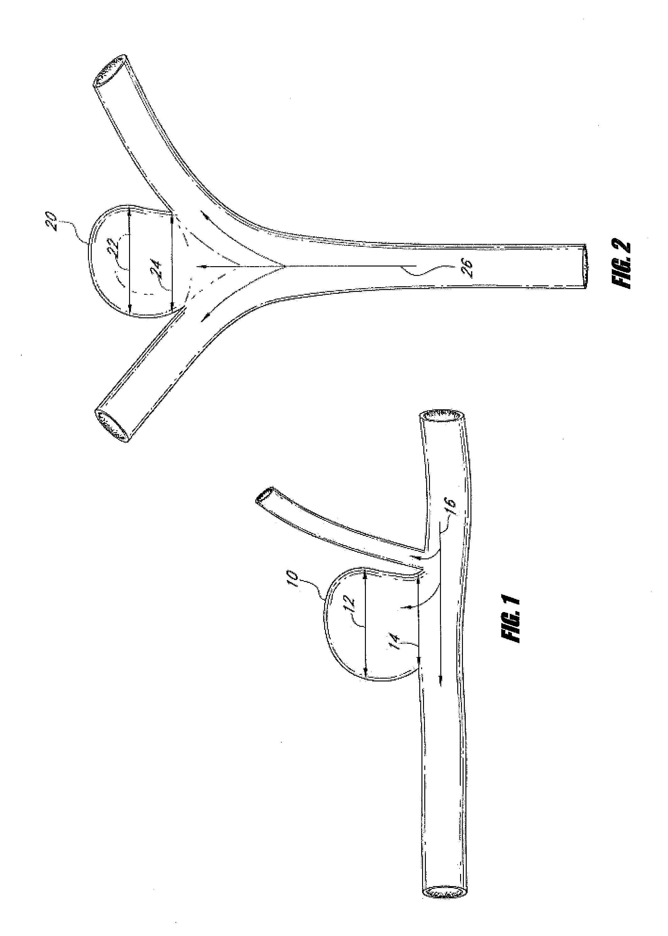 Vascular remodeling device