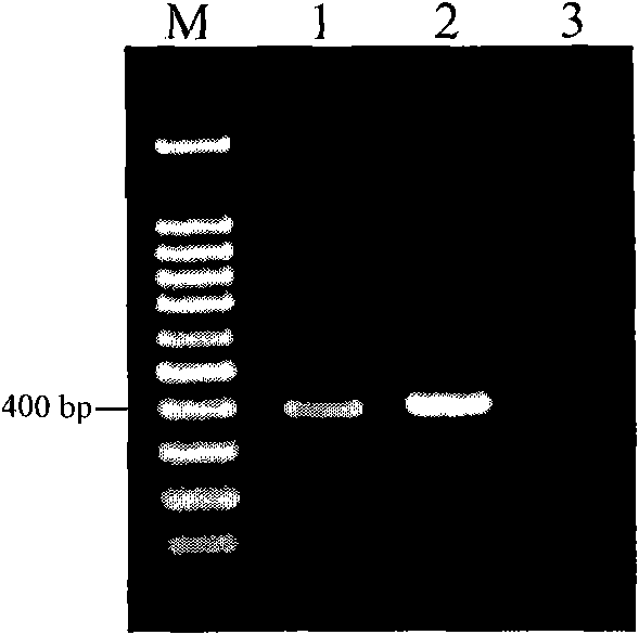 A kind of β-ketothiolase related to the 3-hv monomer synthesis of phbv, its coding gene and application