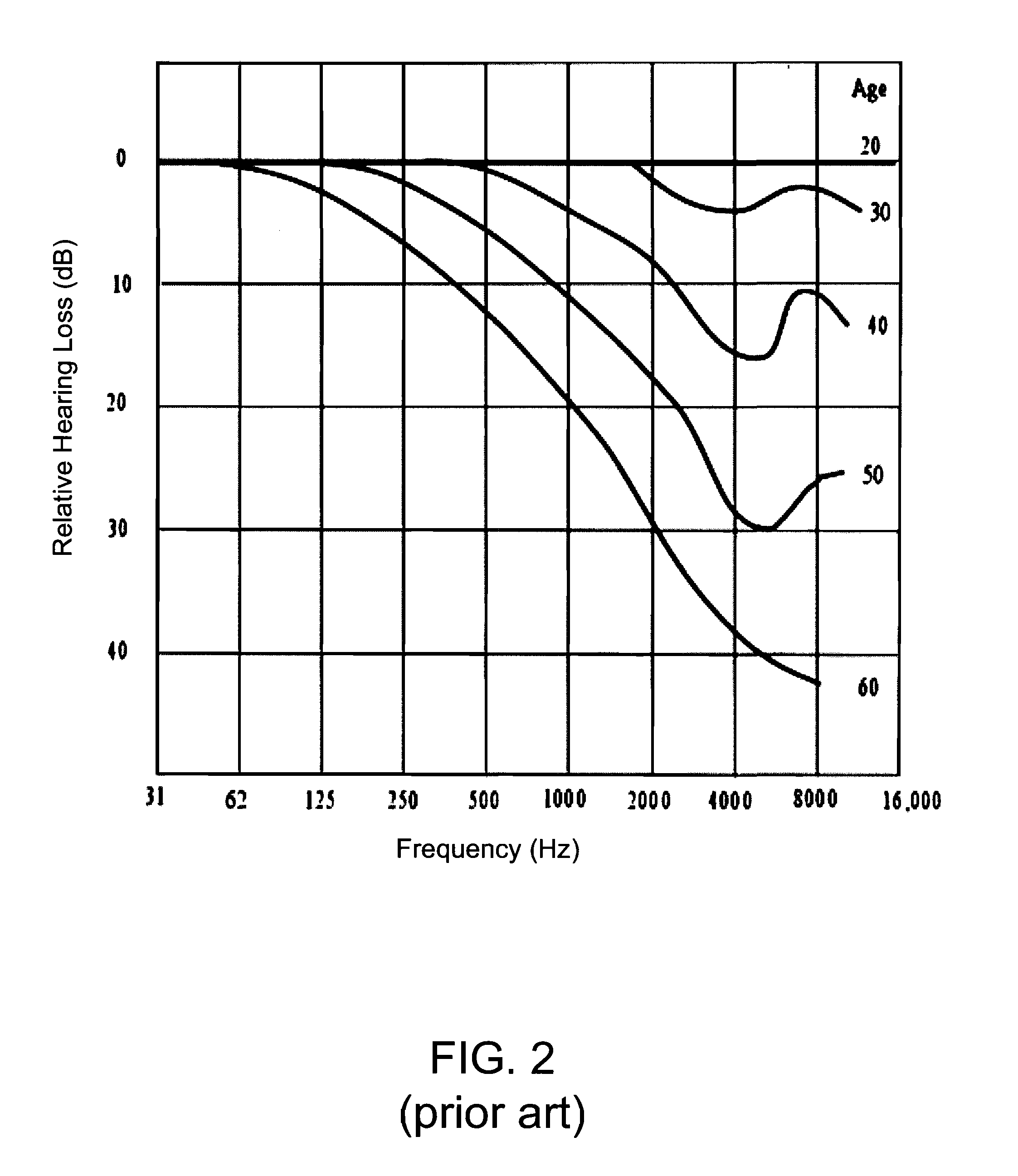 Dynamic compensation of audio signals for improved perceived spectral imbalances