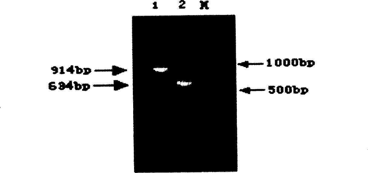 Heavy PSME1 gene for pig to pass breast, and its prepn. method