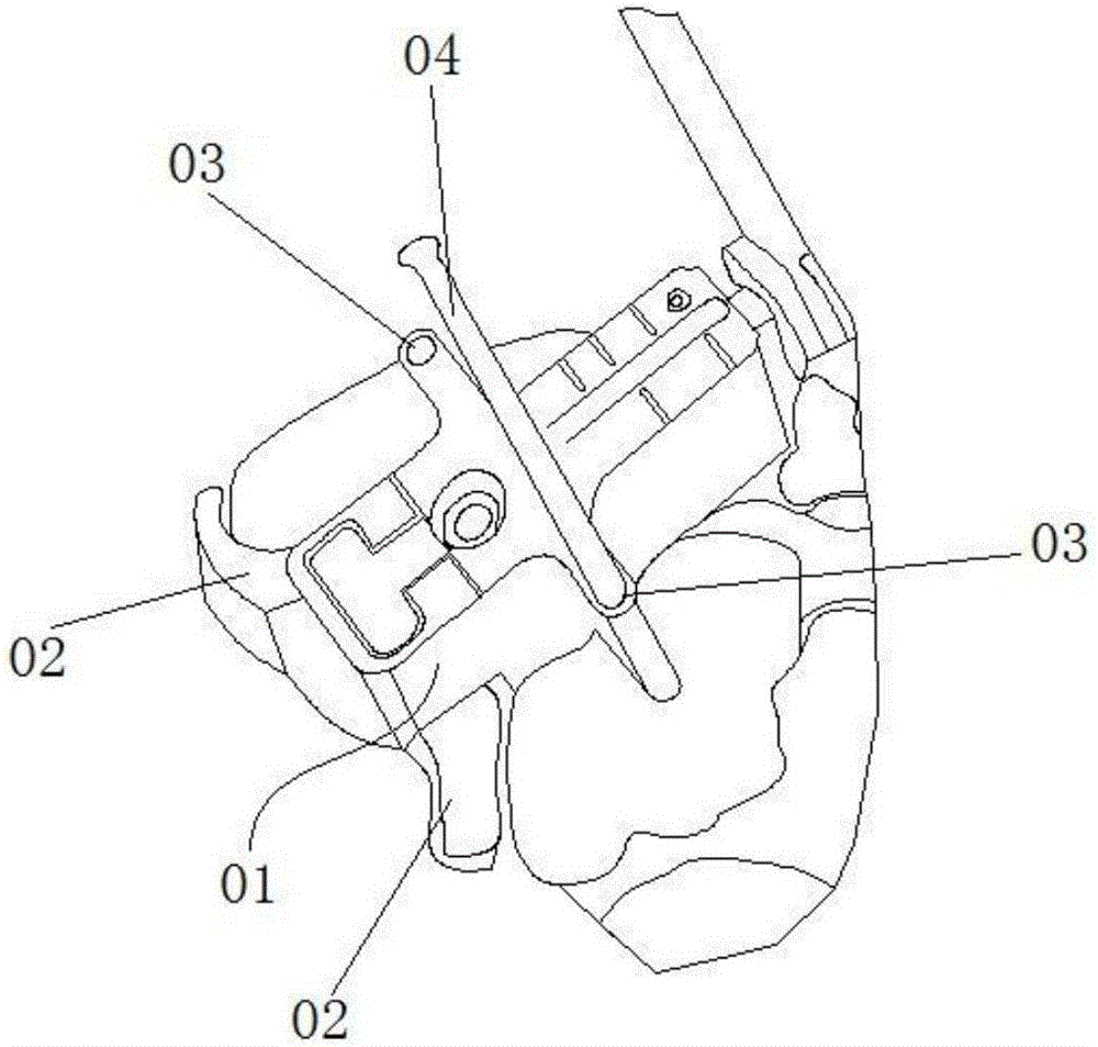 Adjuster for joint replacement and use method of adjuster