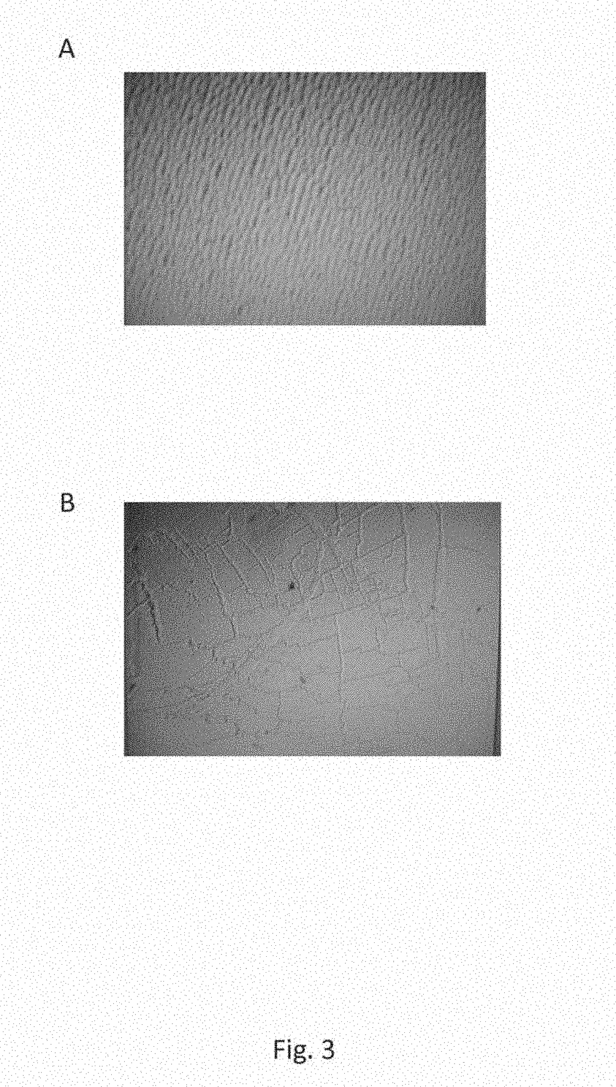 Manganese superoxide dismutase variants and uses thereof