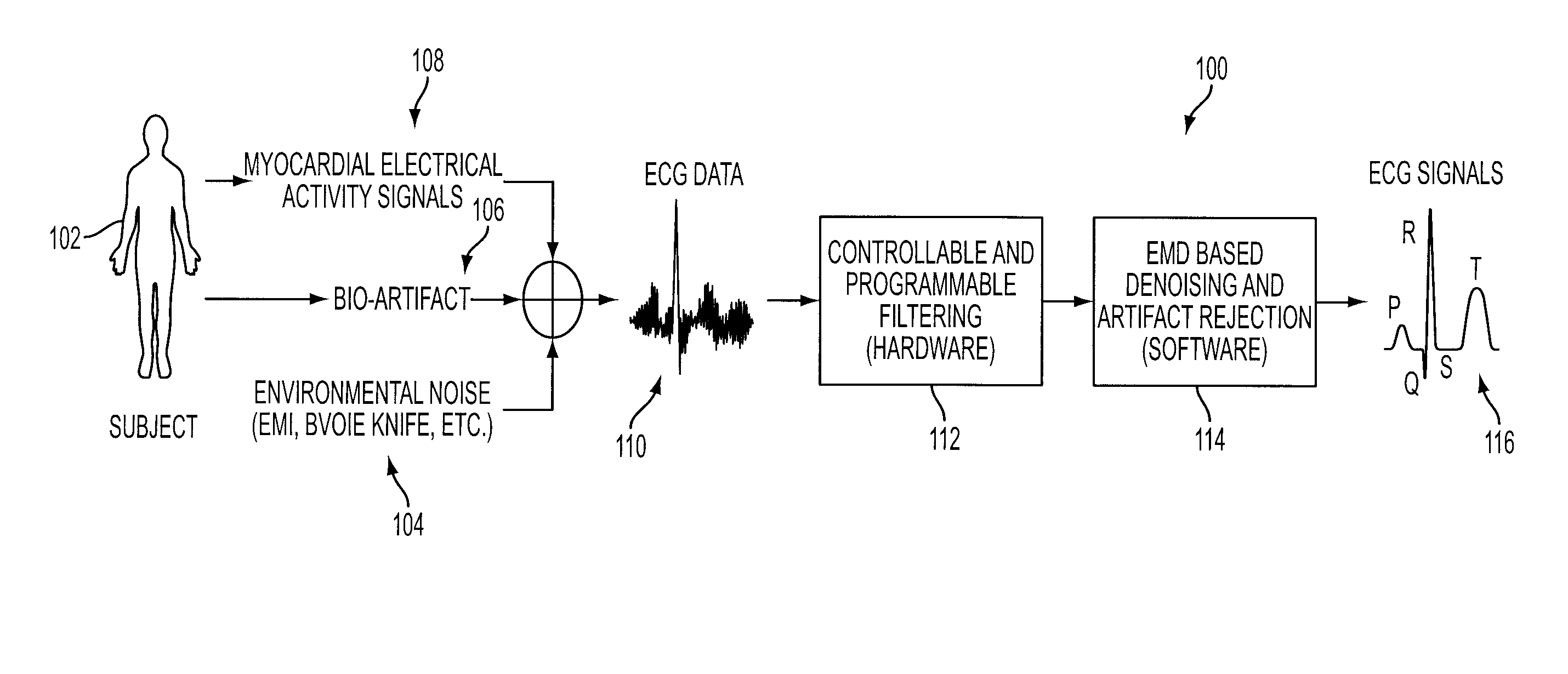 Denoising and Artifact Rejection for Cardiac Signal in a Sensis System