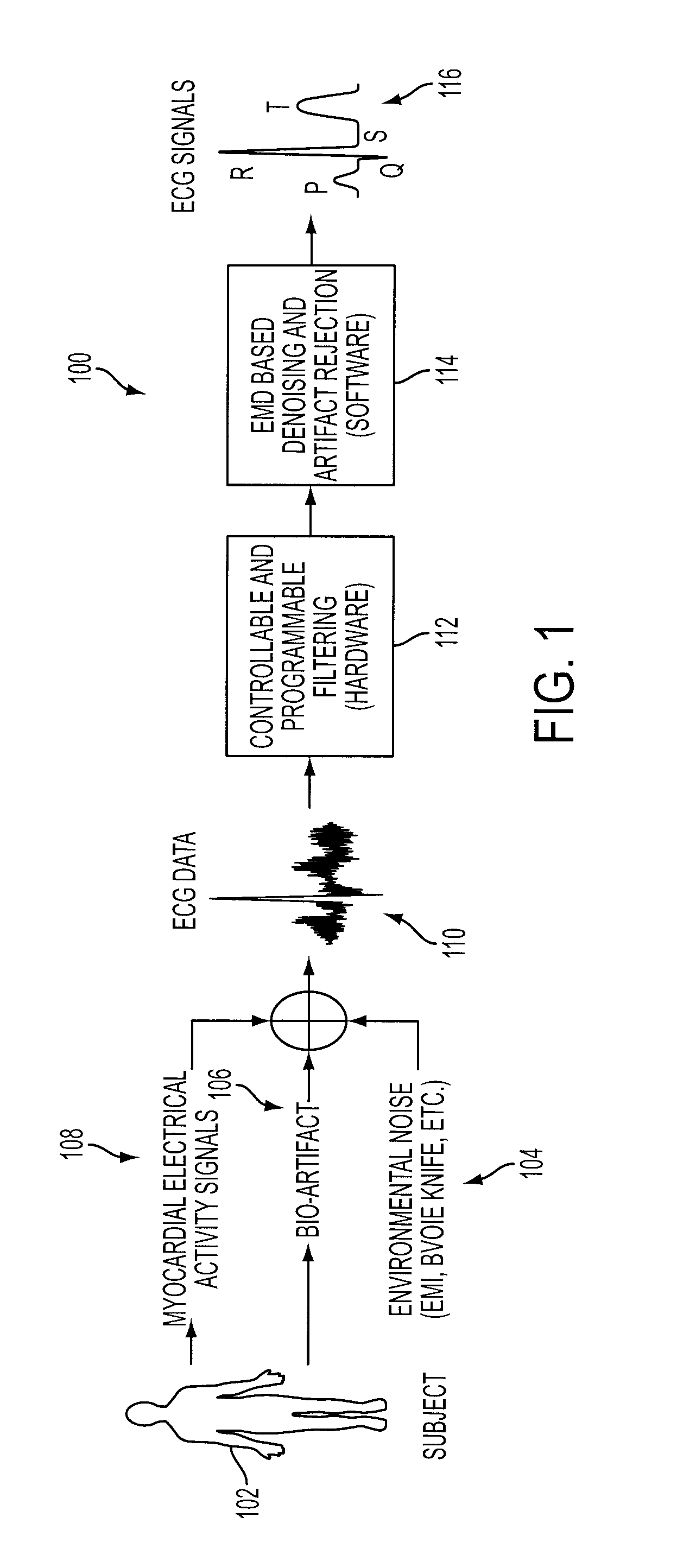 Denoising and Artifact Rejection for Cardiac Signal in a Sensis System