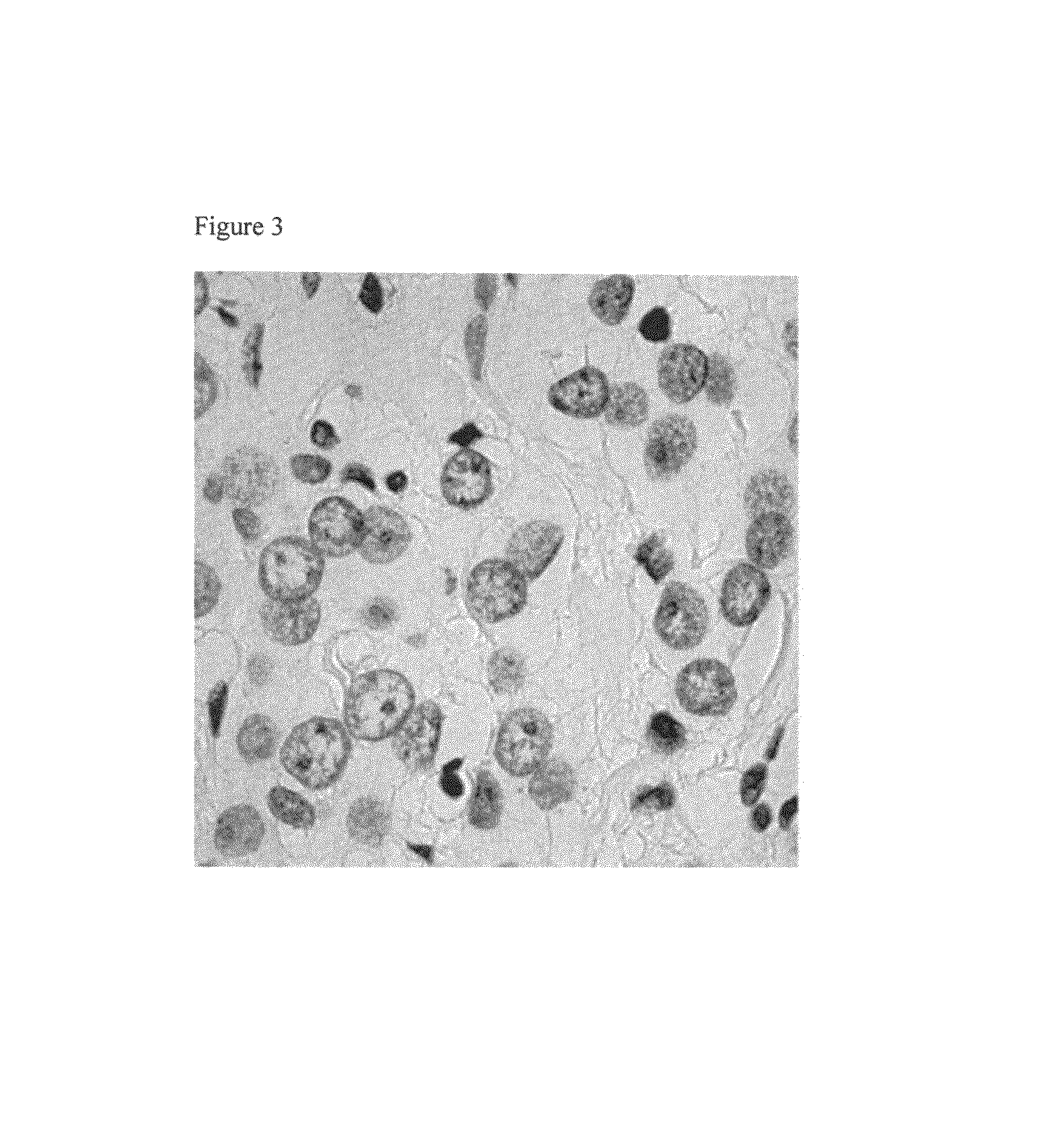 Method and apparatus for aligning microscope images