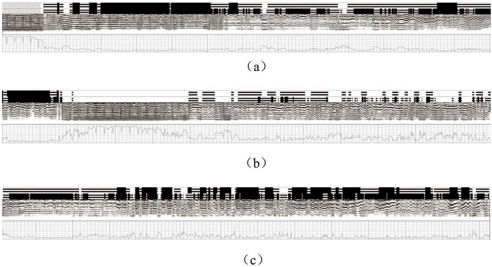 Positive injection back squeeze well cementation method for low pressure and leaky well