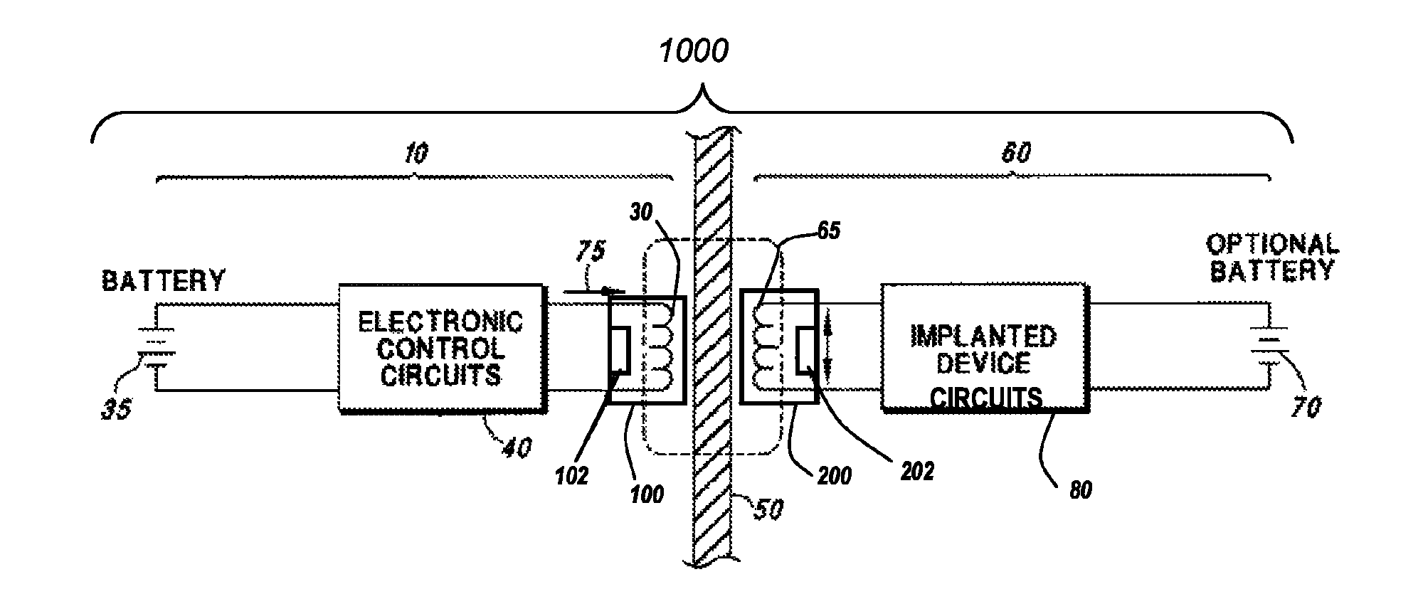 Atraumatic high-retention headpiece