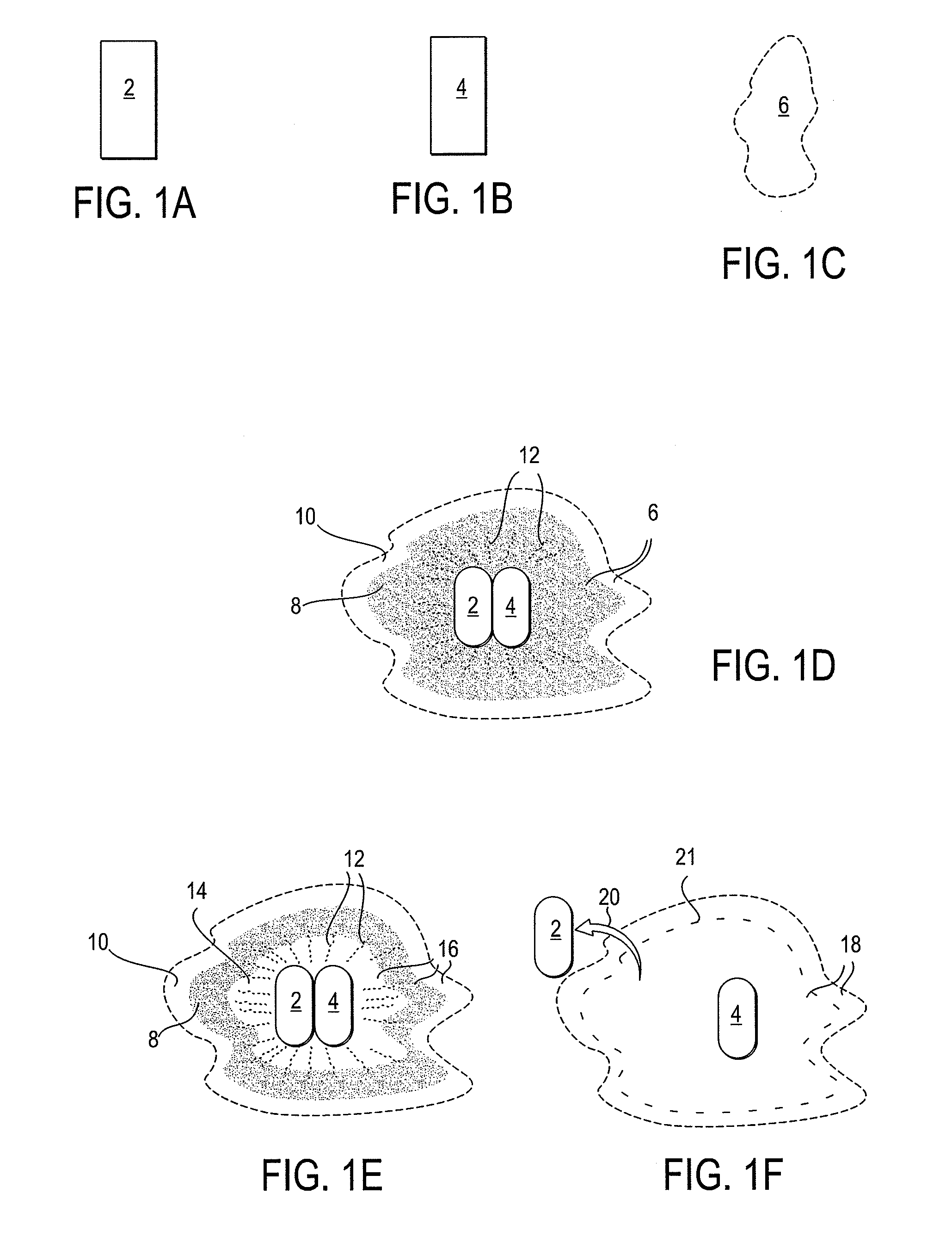 Bone implant and systems that controllably releases silver