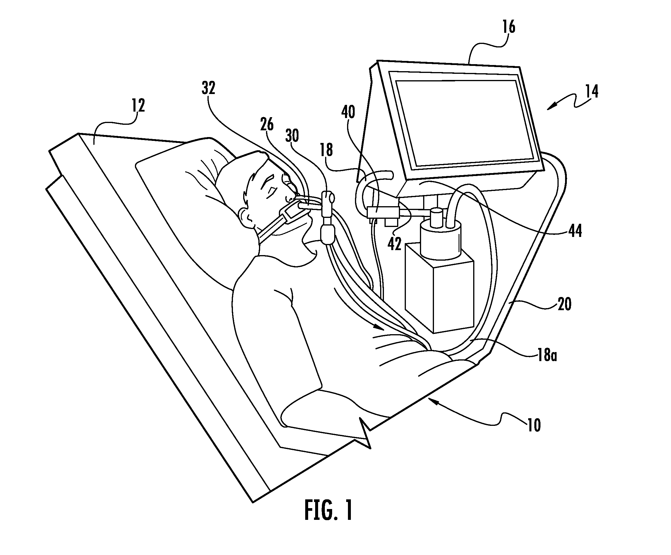 Nebulized ventilation system