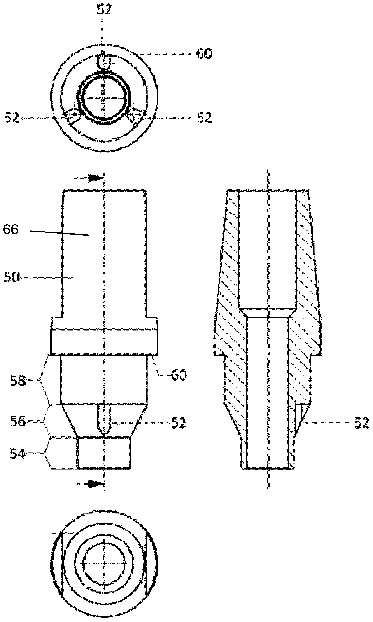 intraosseous single tooth implant