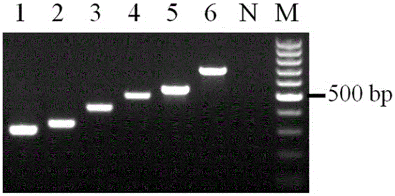 Multiplex PCR kit for detecting bacterial meningitis pathogens