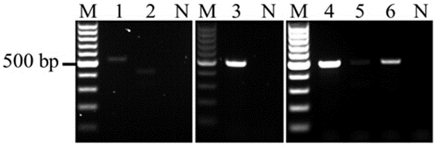 Multiplex PCR kit for detecting bacterial meningitis pathogens