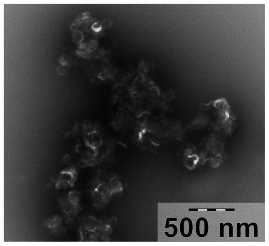 Preparation method of bionic siRNA nano complex with anticancer activity