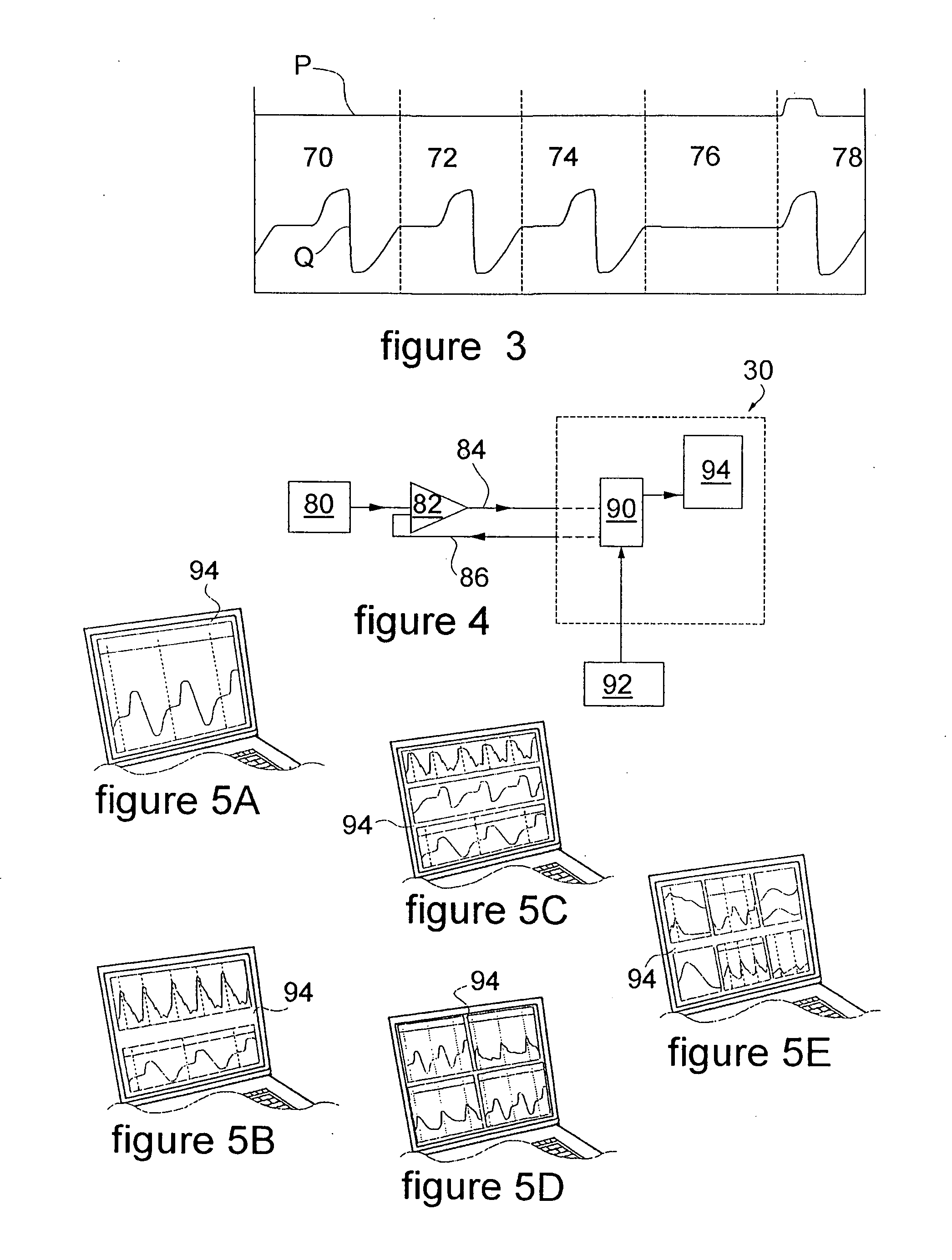 PC-based physiologic monitor and system for resolving apnea episodes during sedation