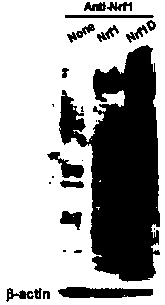 Immunogen for obtaining Nrf1D protein antibody, Nrf1D protein antibody and Elisa detection kit