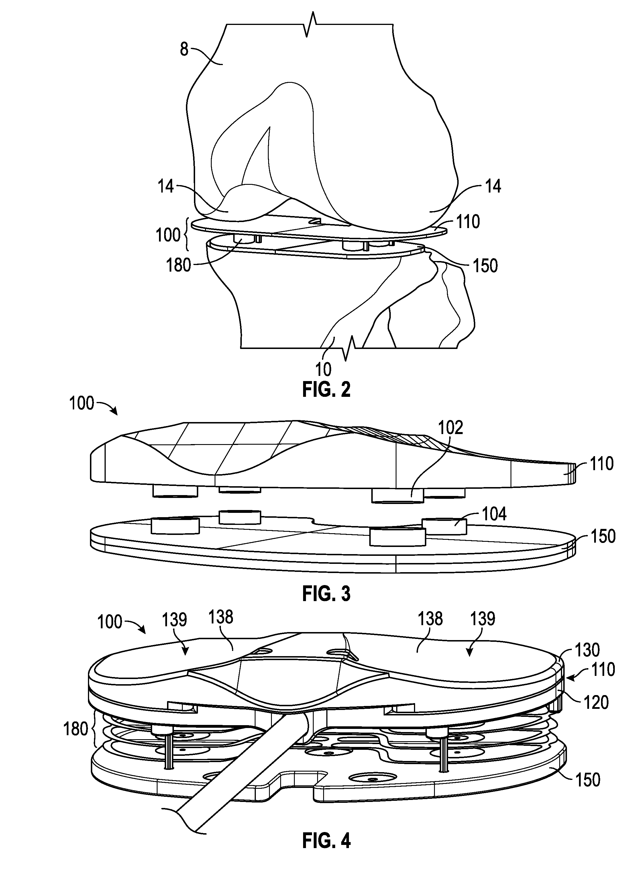 Balancing device for arthroplasty and methods for use