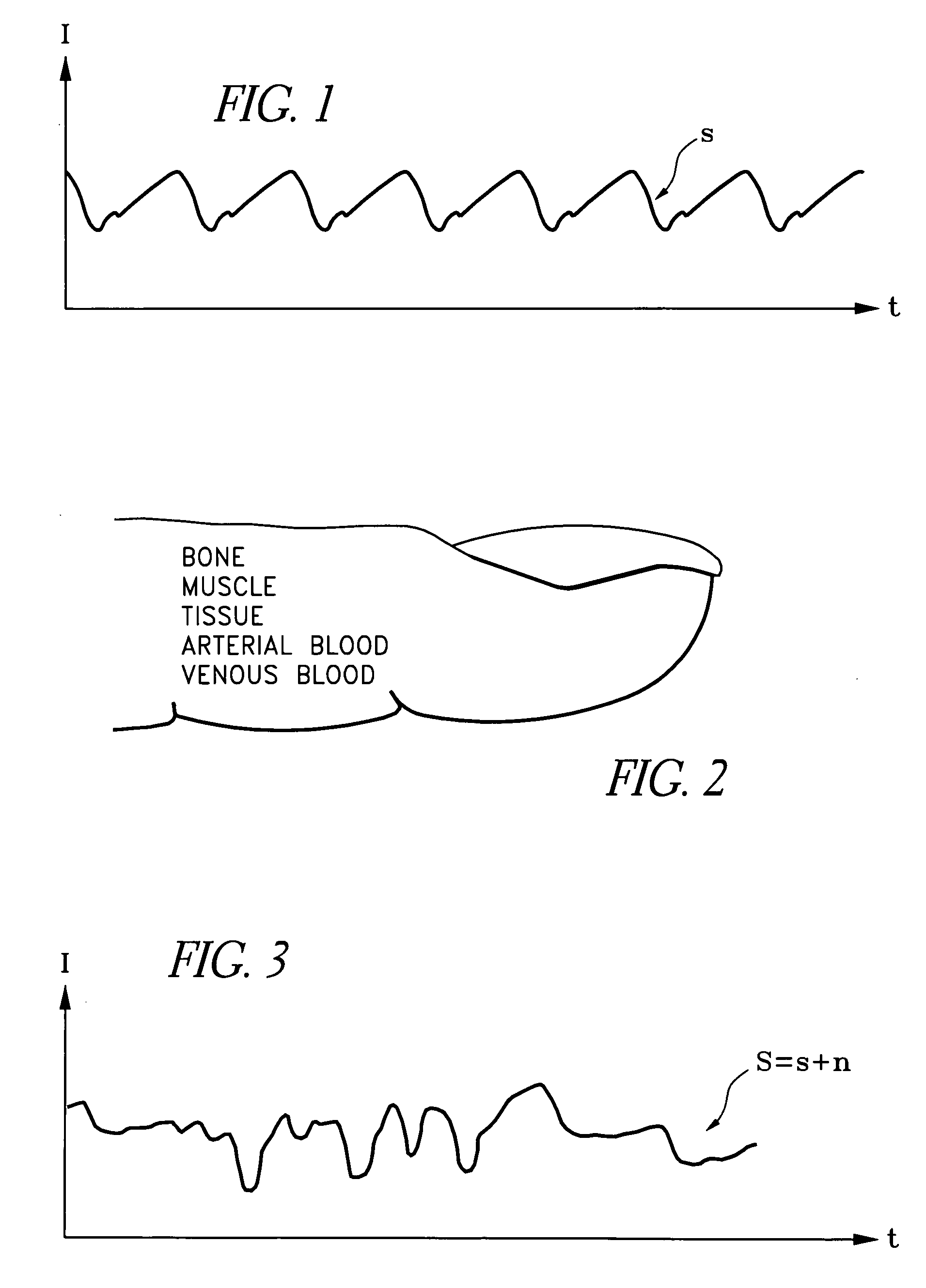 Signal processing apparatus