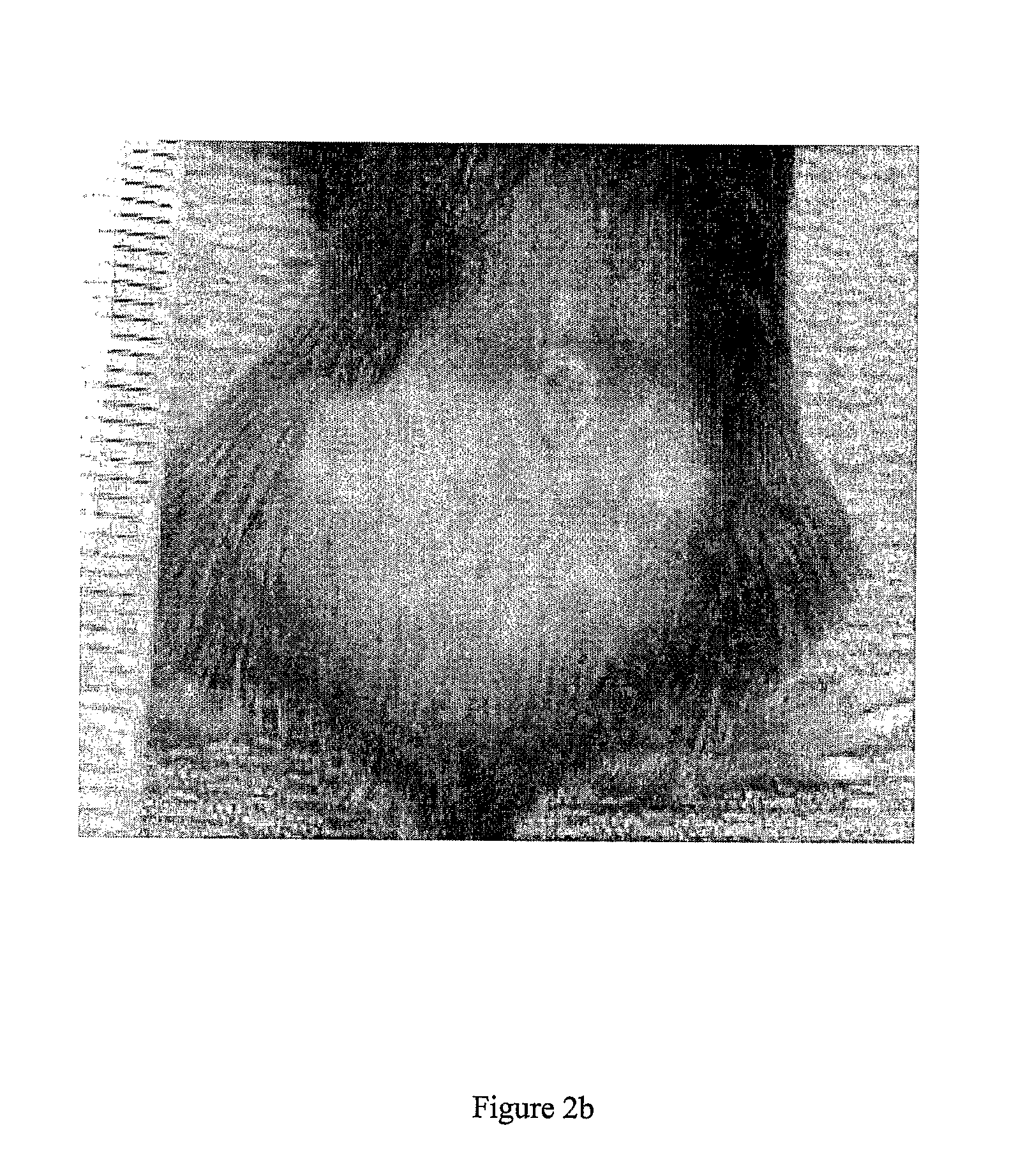 Compositions and uses thereof for the treatment of wounds