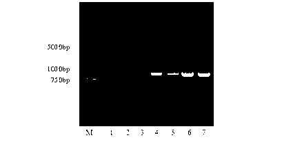 Coding gene of anti-Cry1Ac toxin single-chain variable fragments (scFv) and immuno-polymerase chain reaction (PCR) detection method