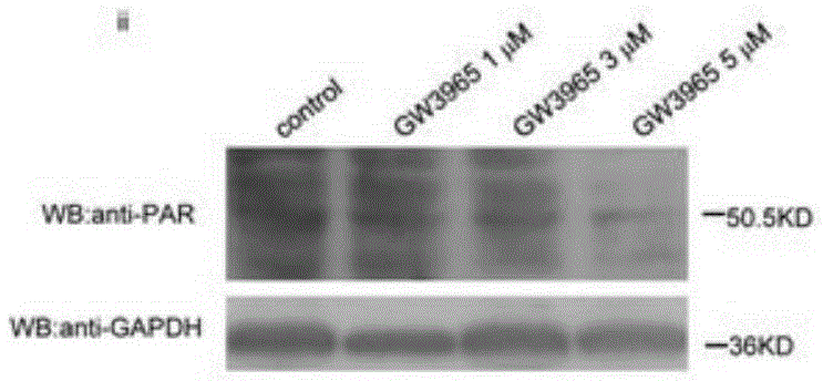 Application of GW3965 as PARP1 inhibitor