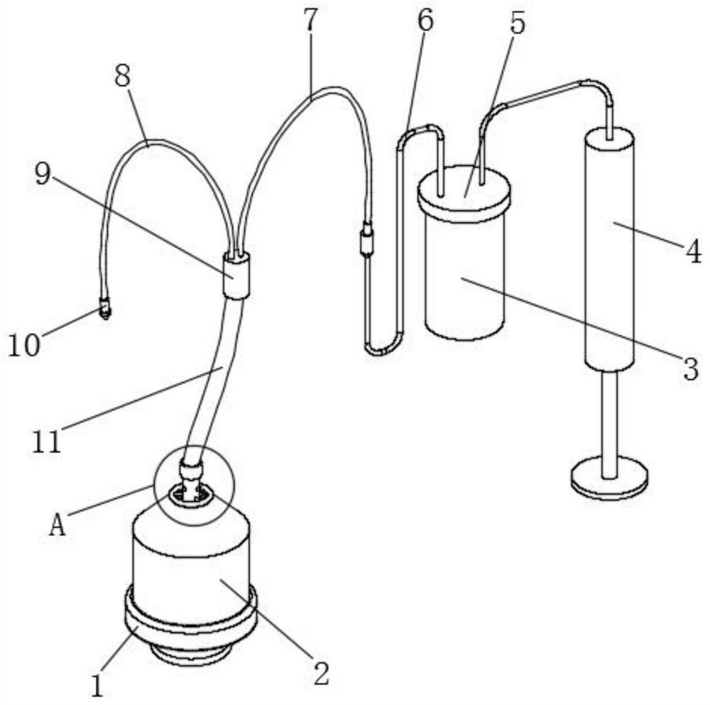 A device for removing stones in clinical hepatobiliary surgery