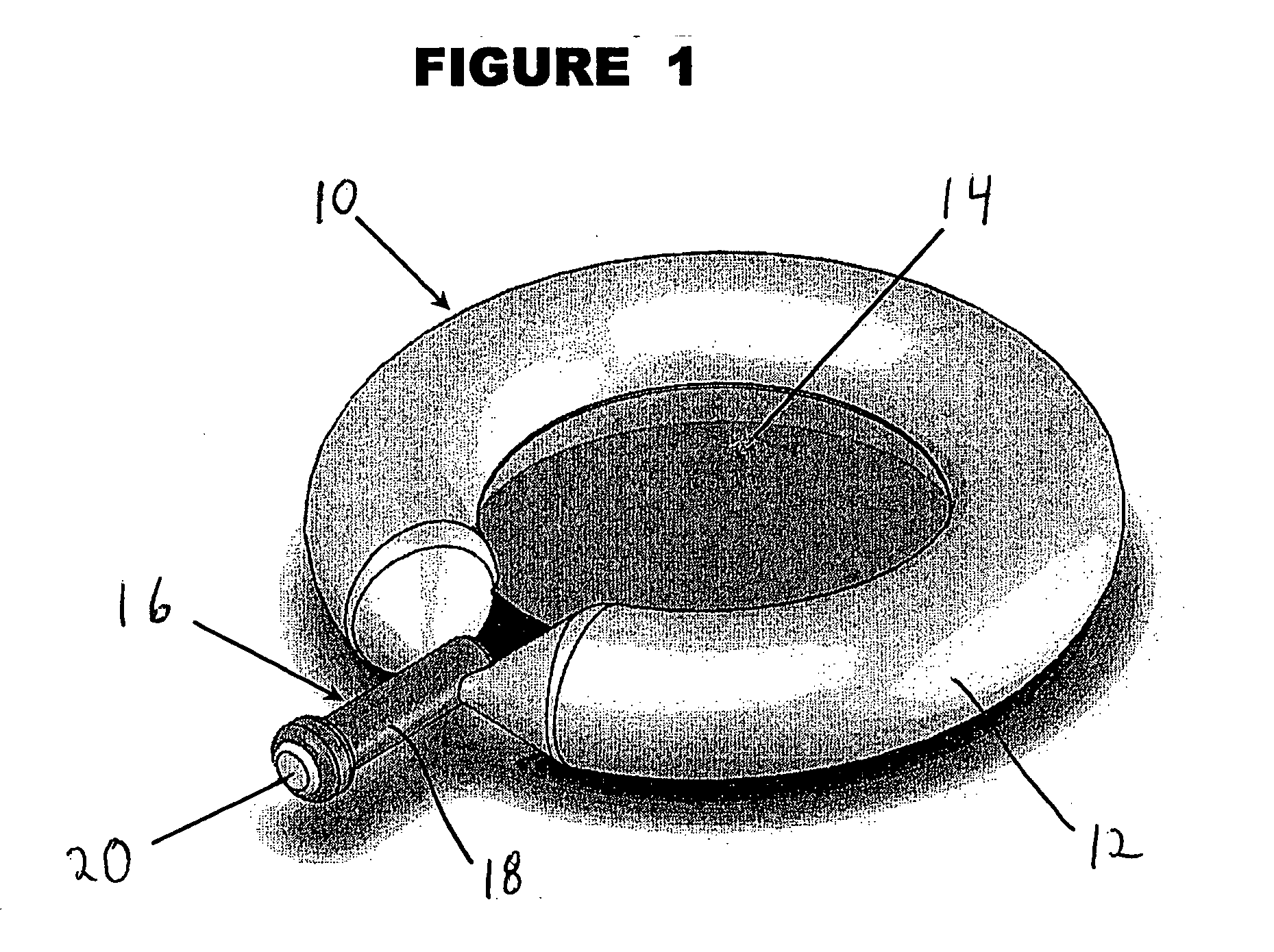 Anatomical spacer and method to deploy