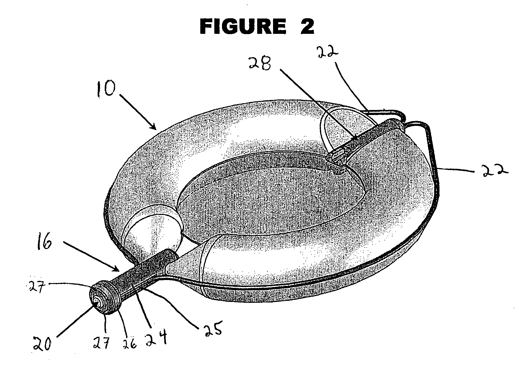 Anatomical spacer and method to deploy