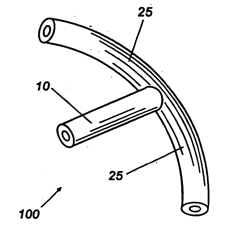 Shunt device and method for treating glaucoma