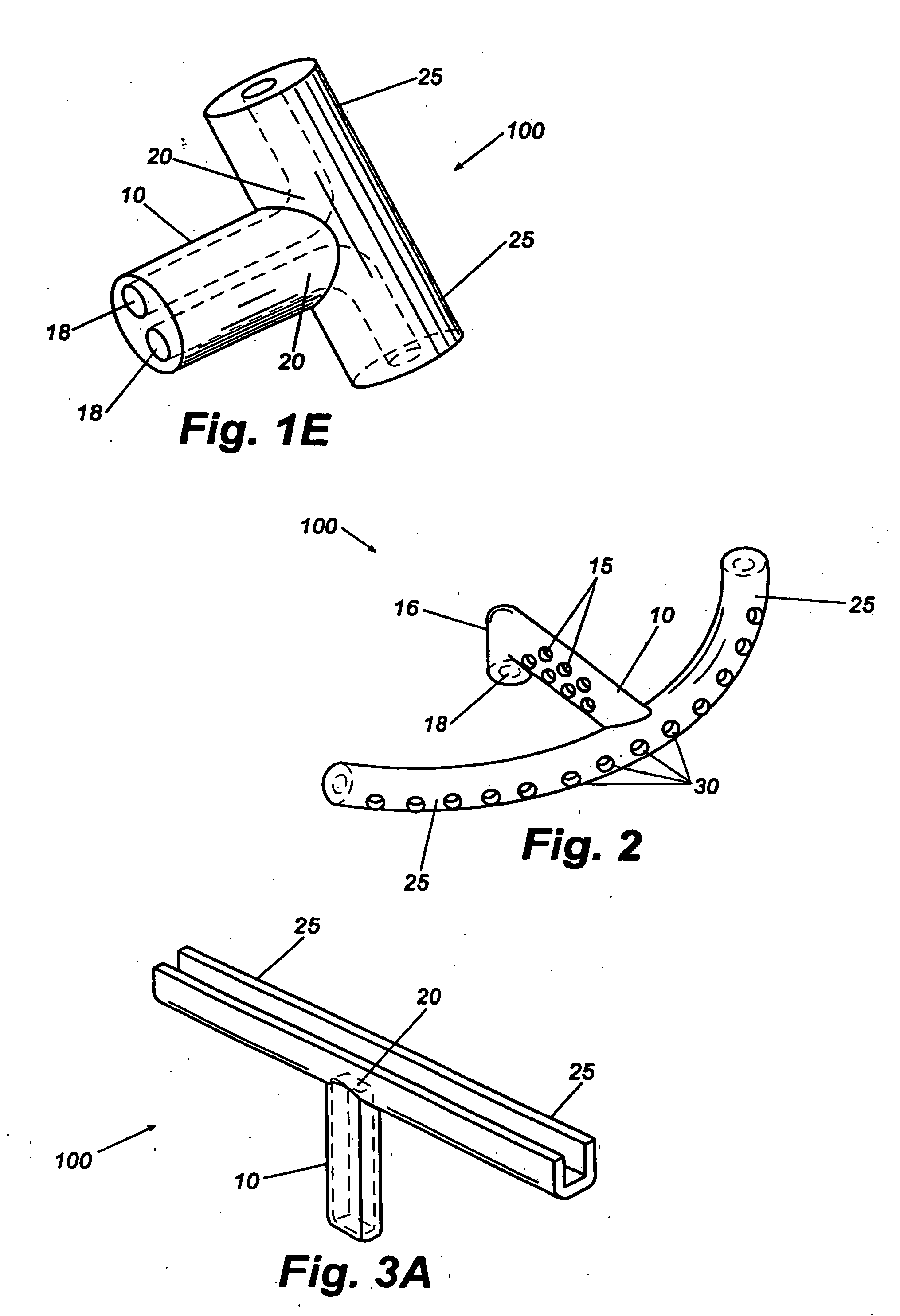 Shunt device and method for treating glaucoma