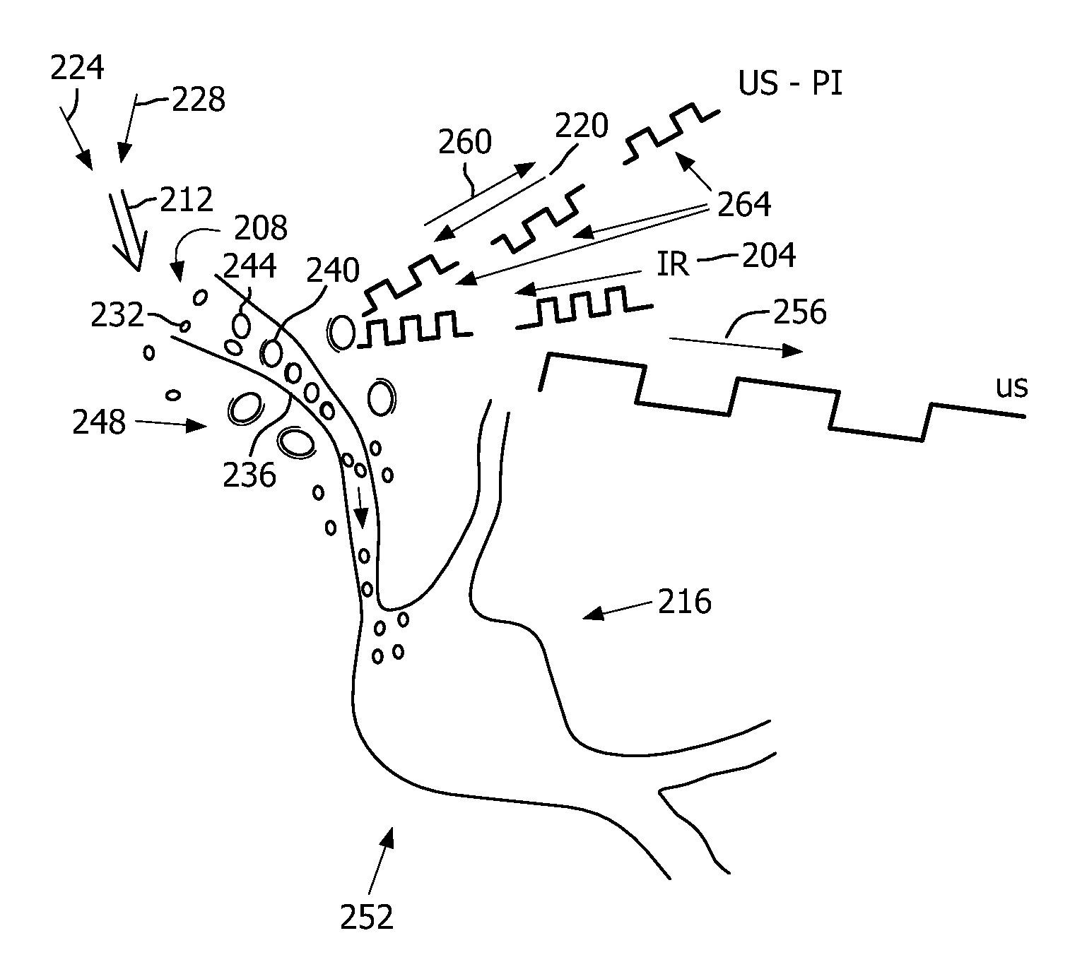 Photoacoustic contrast agent based active ultrasound imaging