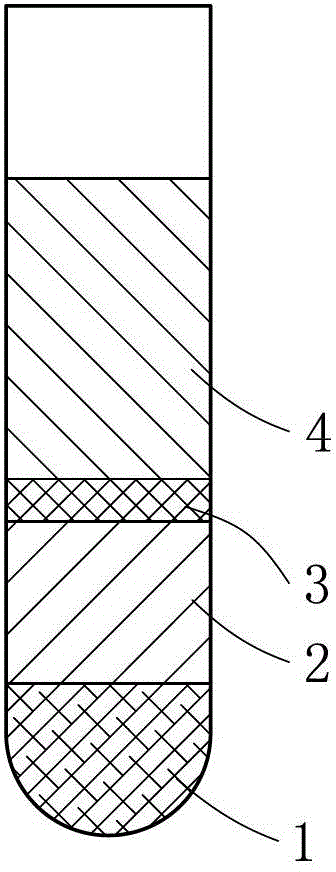 Platelet-rich plasma and bone powder collecting and separating device in operation