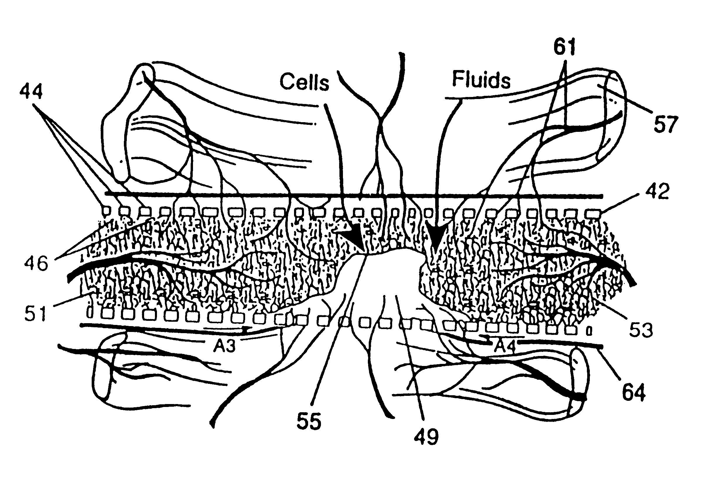 Resorbable, macro-porous non-collapsing and flexible membrane barrier for skeletal repair and regeneration